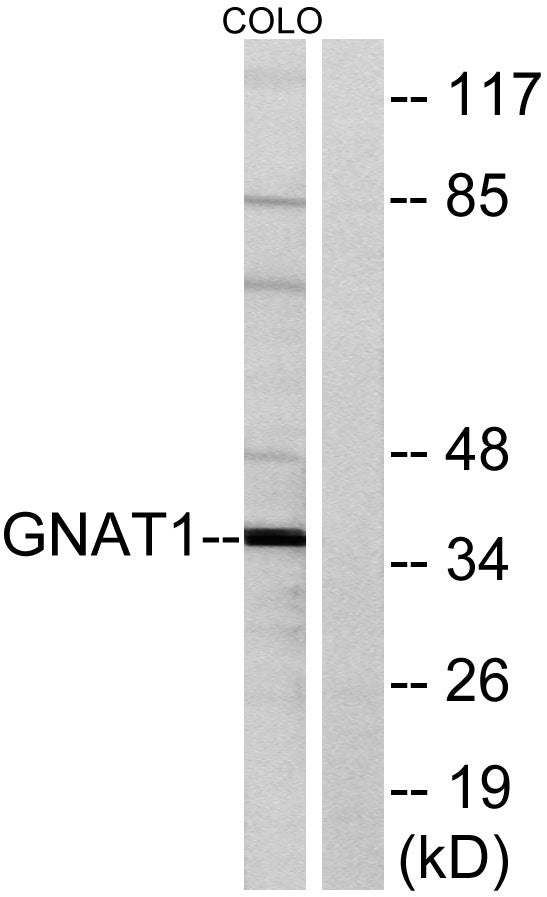 Gα t1 Rabbit Polyclonal Antibody