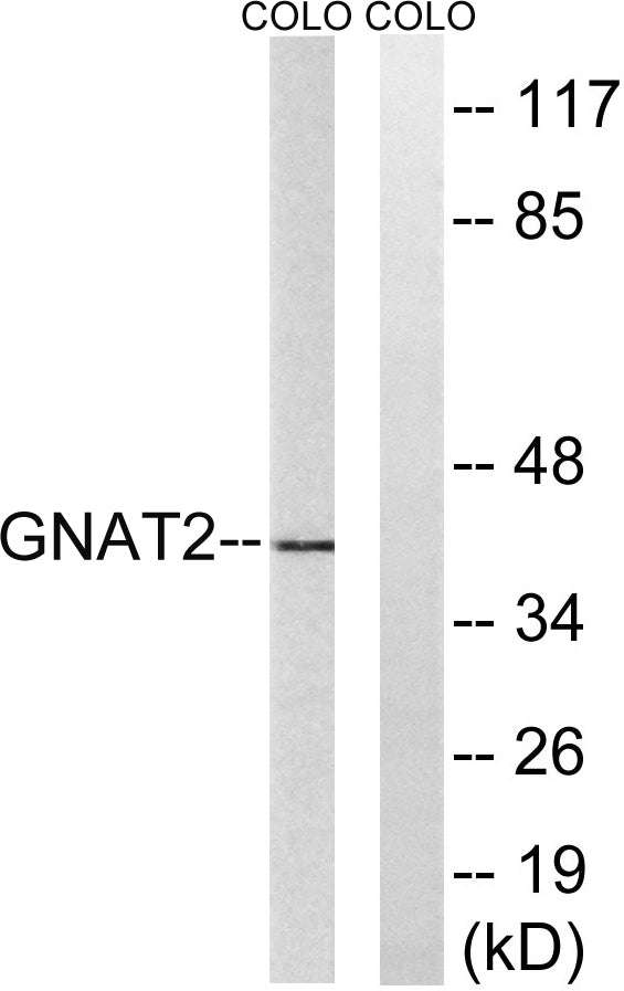 Gα t2 Rabbit Polyclonal Antibody