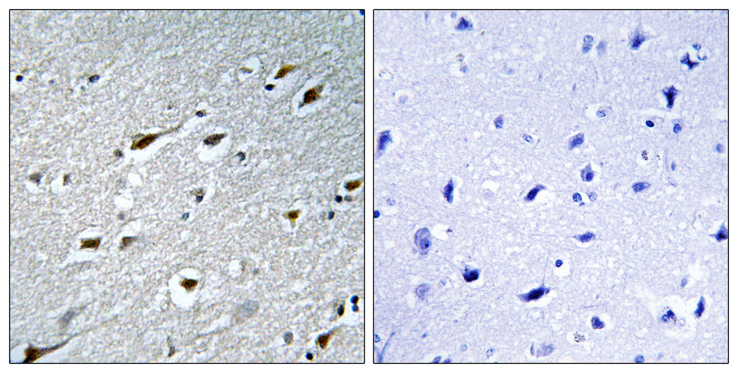 HAND1 Rabbit Polyclonal Antibody
