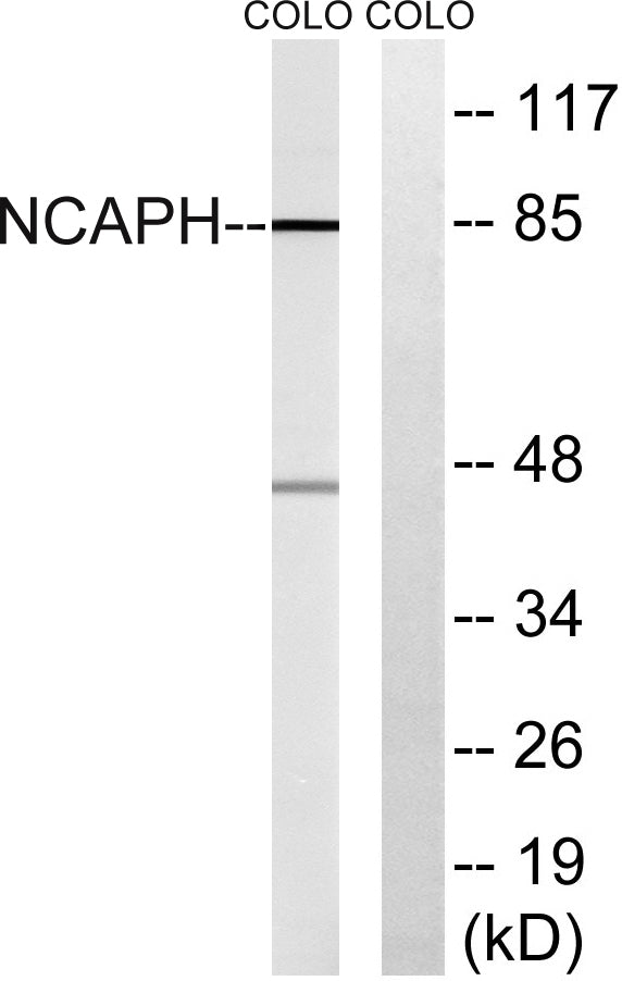 hCAP-H Rabbit Polyclonal Antibody