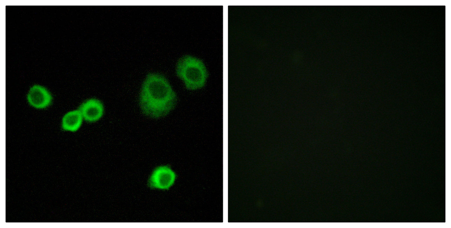 HCCS Rabbit Polyclonal Antibody