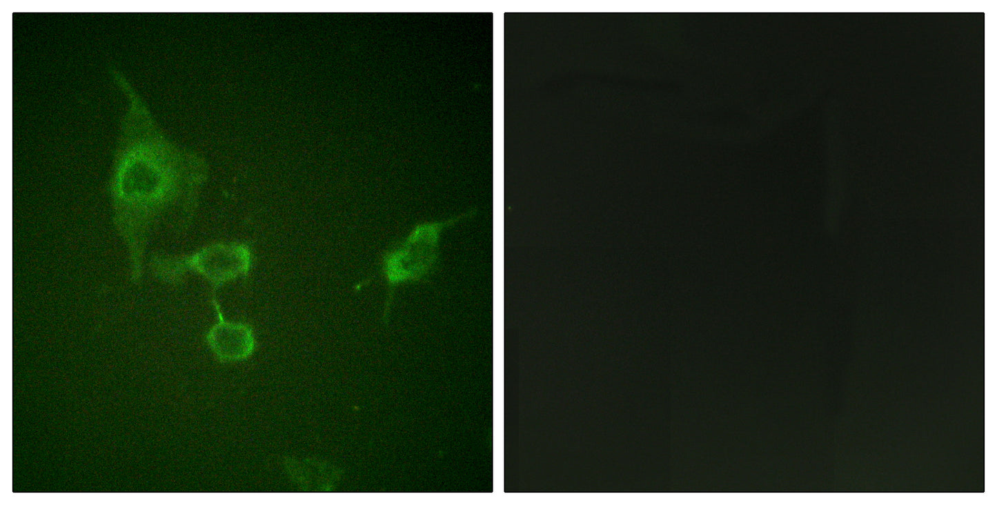 Hck Rabbit Polyclonal Antibody