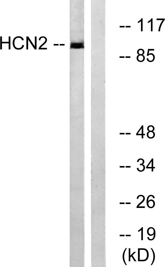 HCN2 Rabbit Polyclonal Antibody