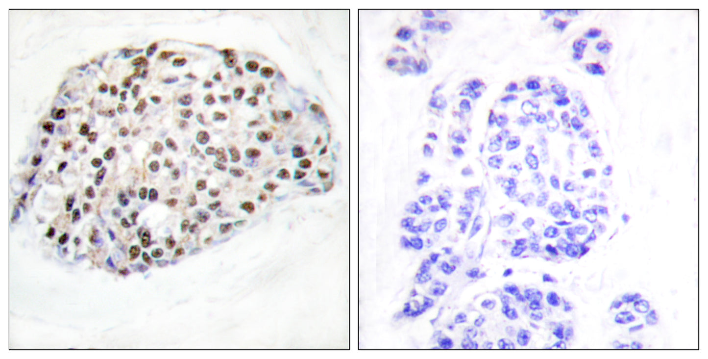 HDAC1 Rabbit Polyclonal Antibody
