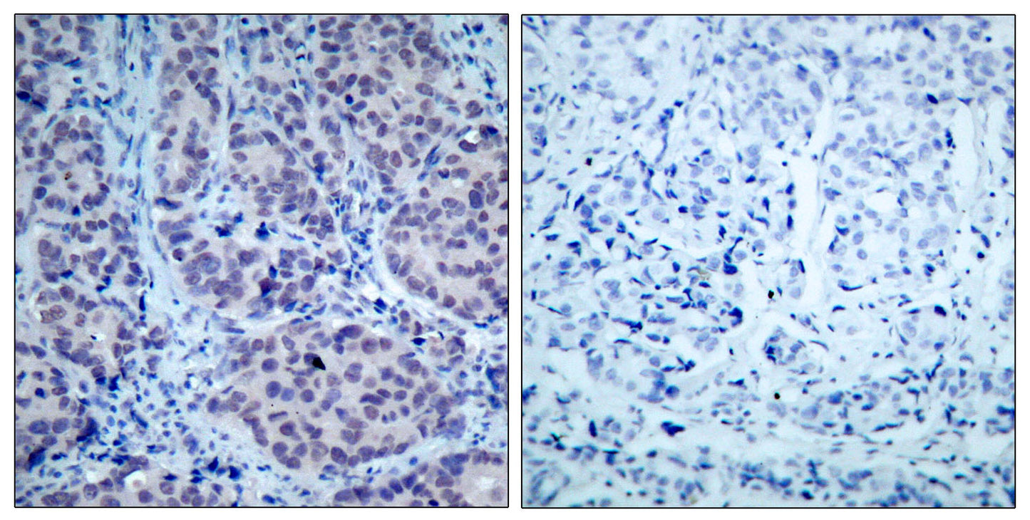 HDAC2 Rabbit Polyclonal Antibody