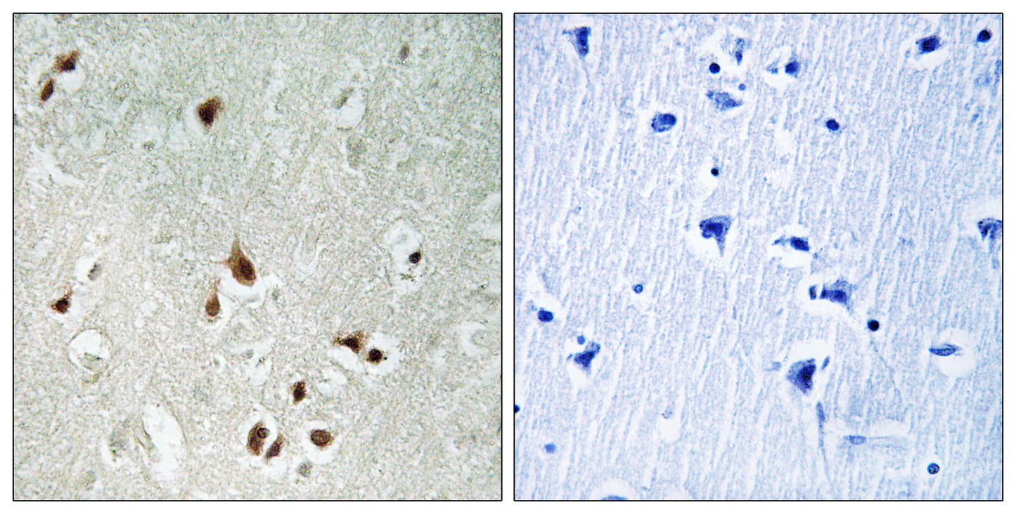 HDAC5/9 Rabbit Polyclonal Antibody