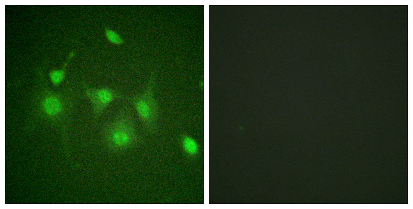 HDAC6 Rabbit Polyclonal Antibody