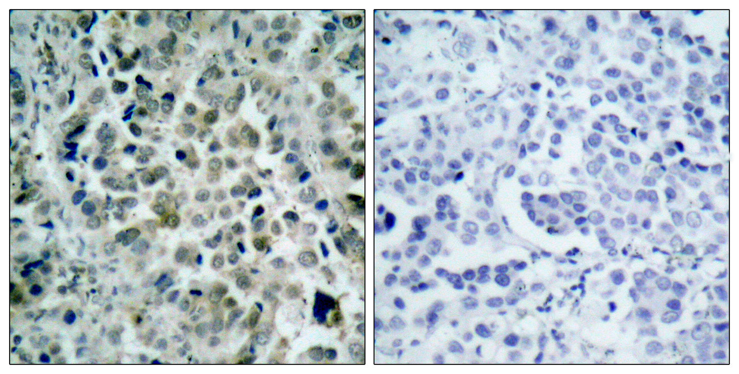 HDAC8 Rabbit Polyclonal Antibody