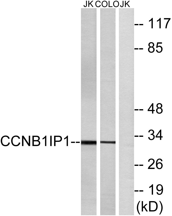 HEI10 Rabbit Polyclonal Antibody