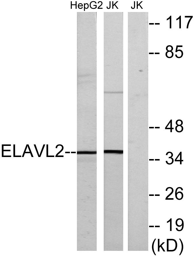 Hel-N1 Rabbit Polyclonal Antibody