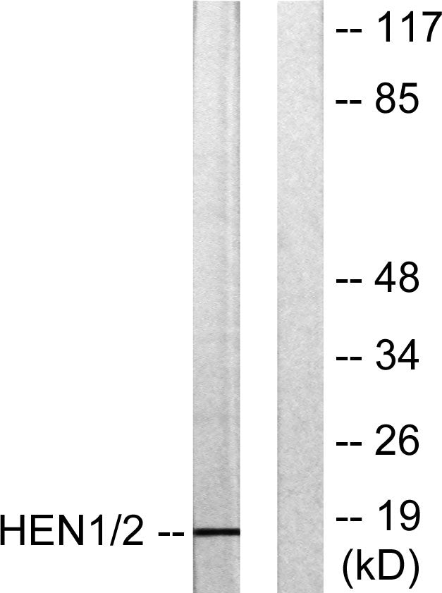 HEN1/2 Rabbit Polyclonal Antibody
