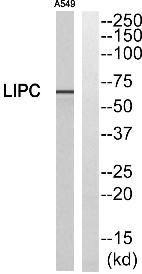 Hepatic Lipase Rabbit Polyclonal Antibody