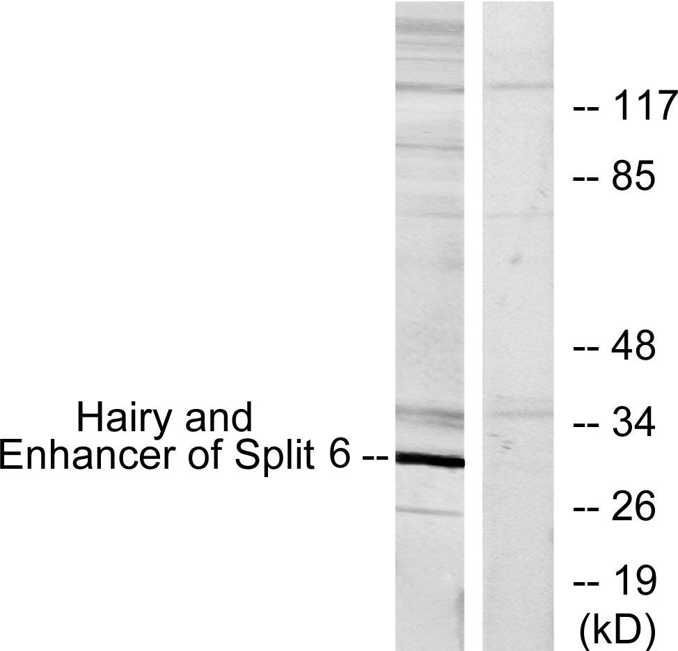 HES-6 Rabbit Polyclonal Antibody