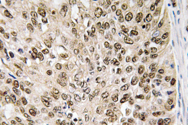 HIF-1α Rabbit Polyclonal Antibody