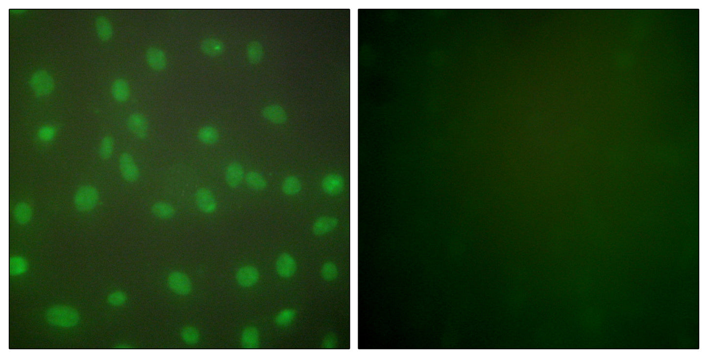 Histone deacetylase 1 Rabbit Polyclonal Antibody