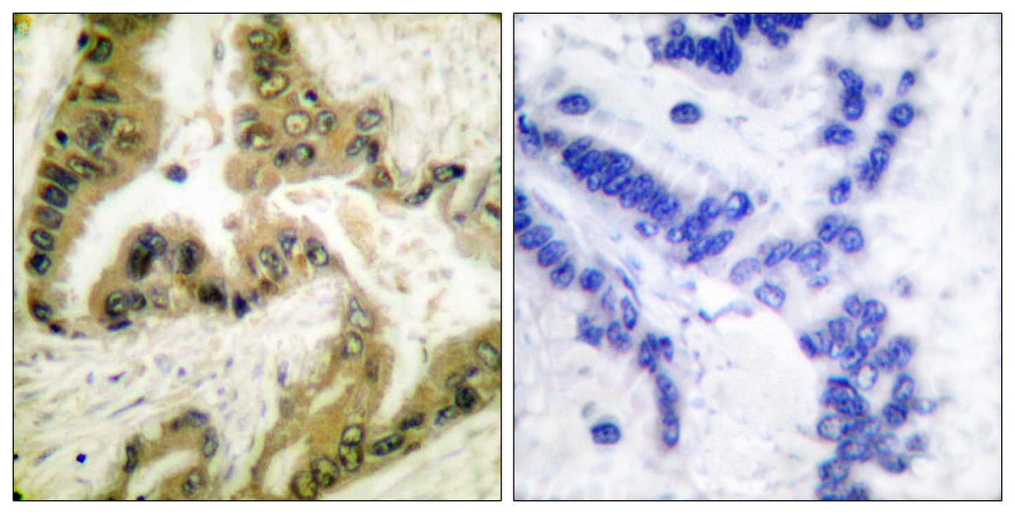 Histone deacetylase 10 Rabbit Polyclonal Antibody
