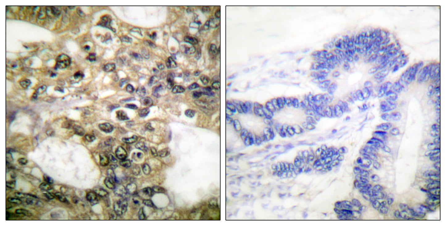 Histone deacetylase 6 Rabbit Polyclonal Antibody