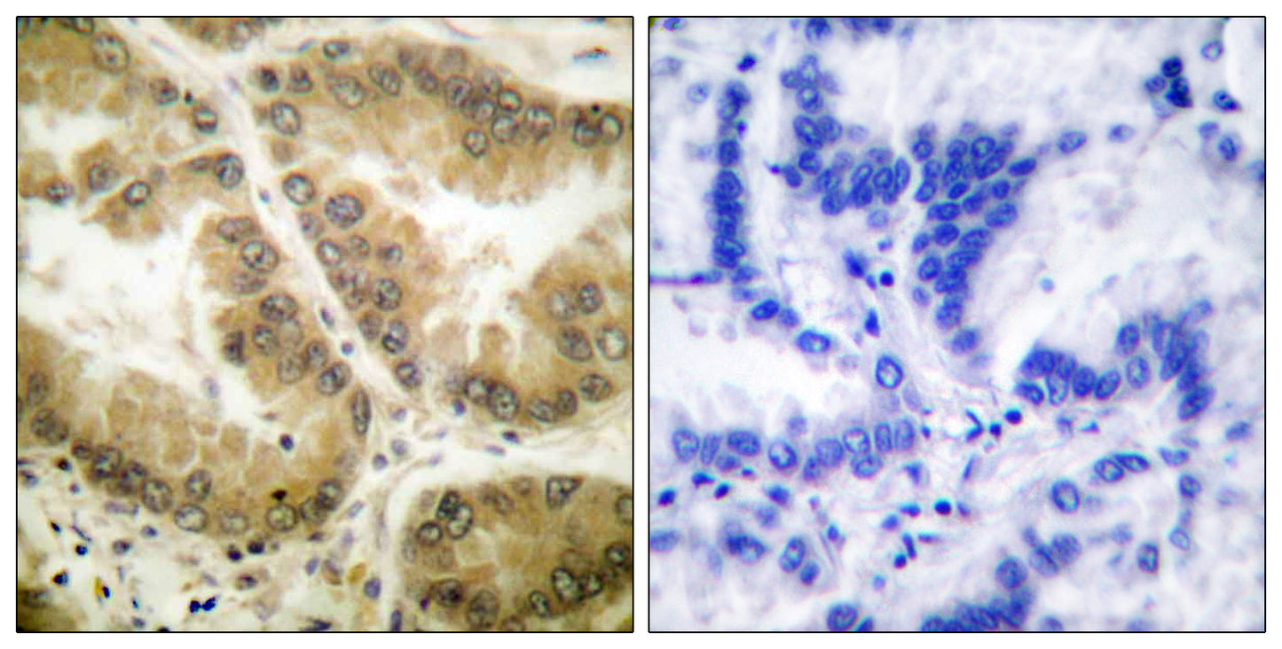 Histone deacetylase 7a Rabbit Polyclonal Antibody