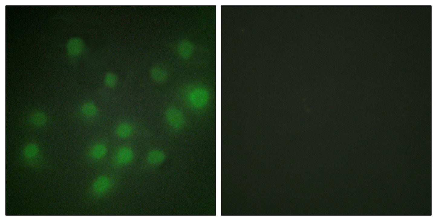 HKR1 Rabbit Polyclonal Antibody