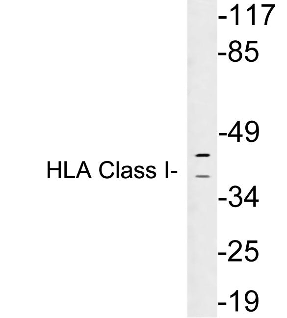 HLA Class I Rabbit Polyclonal Antibody