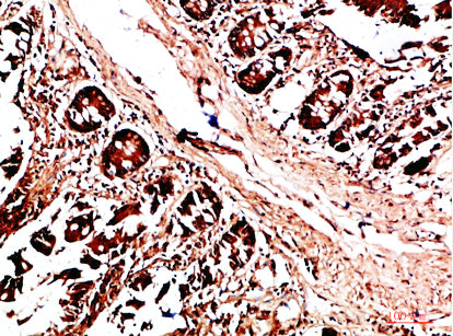 HLA-DQA1 Rabbit Polyclonal Antibody