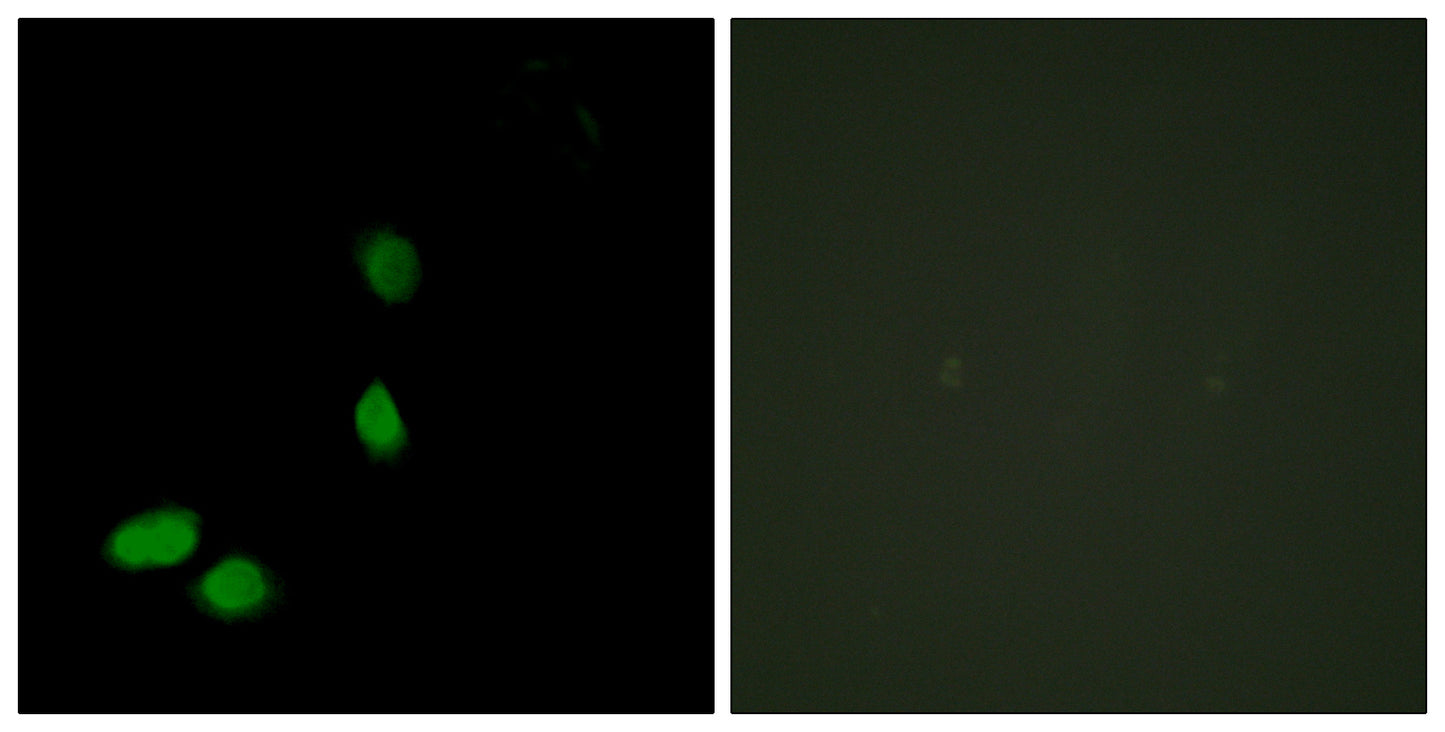 HMG-17 Rabbit Polyclonal Antibody