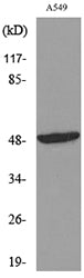 HNF-3α/β/γ Rabbit Polyclonal Antibody
