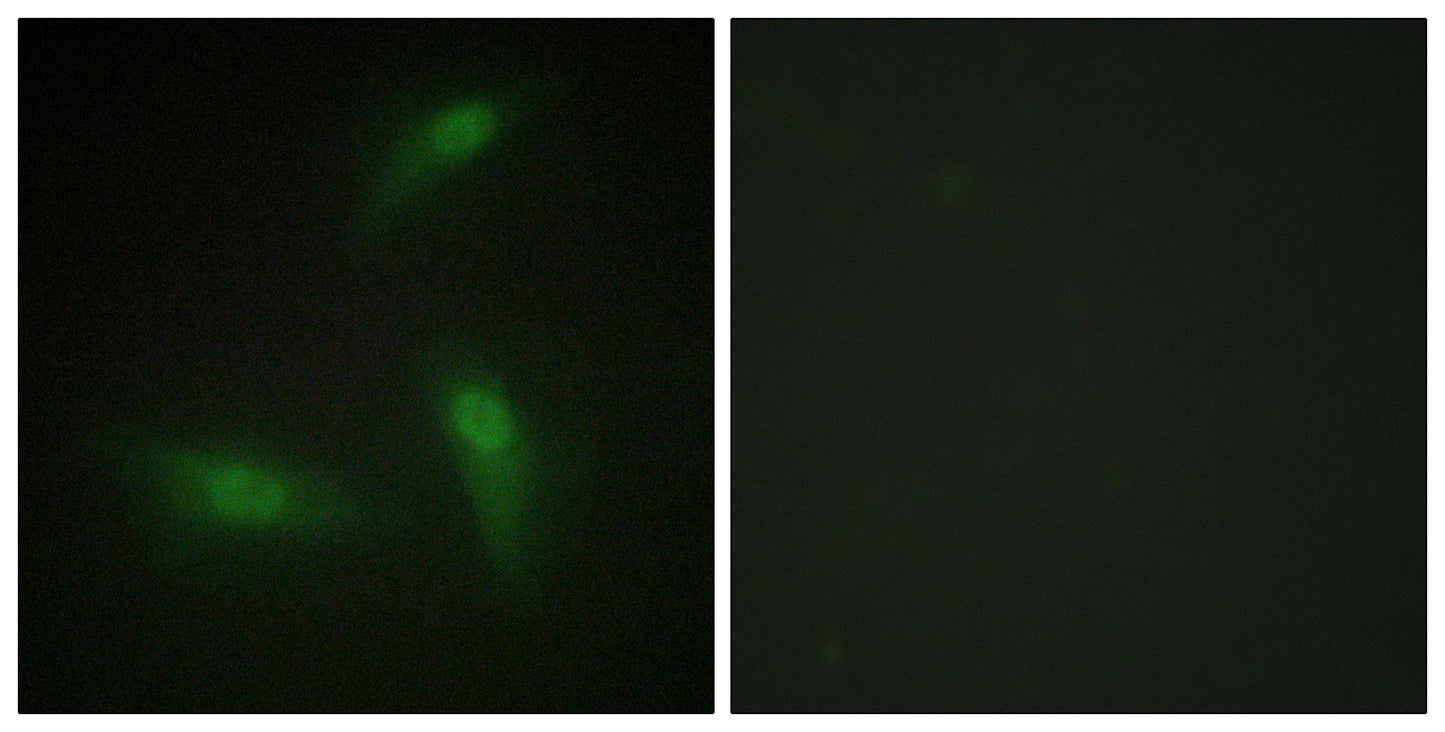 hnRNP A1 Rabbit Polyclonal Antibody