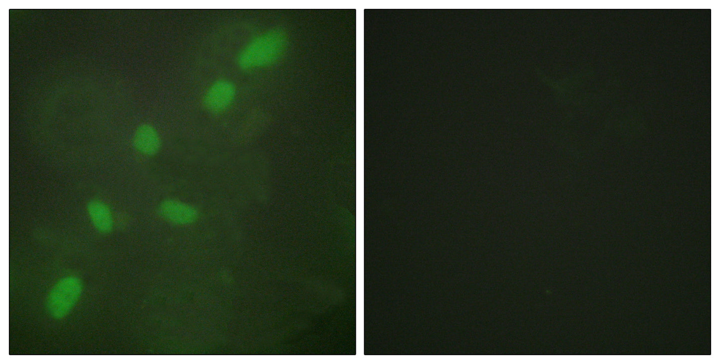 hnRNP A2/B1 Rabbit Polyclonal Antibody