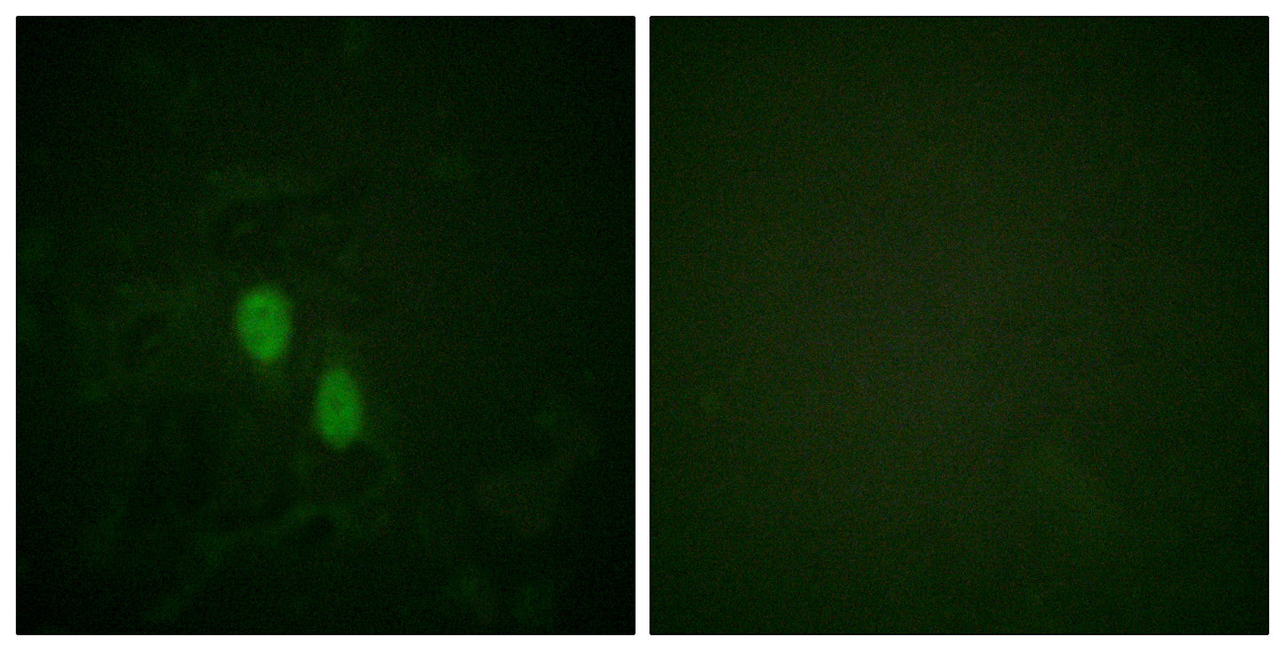 hnRNP D0 Rabbit Polyclonal Antibody