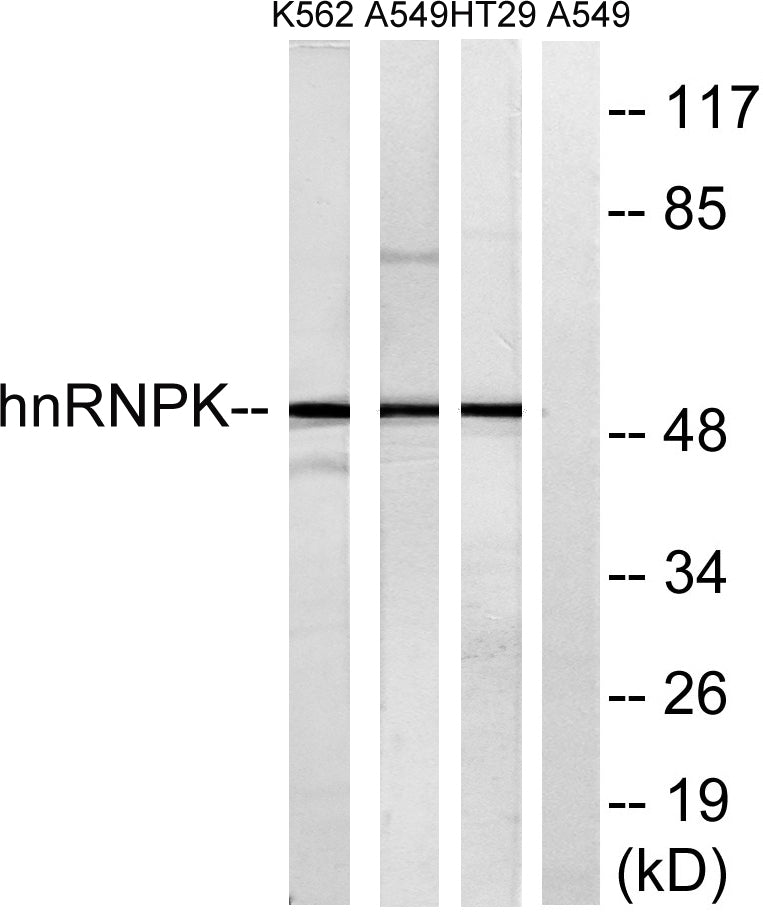 hnRNP K Rabbit Polyclonal Antibody