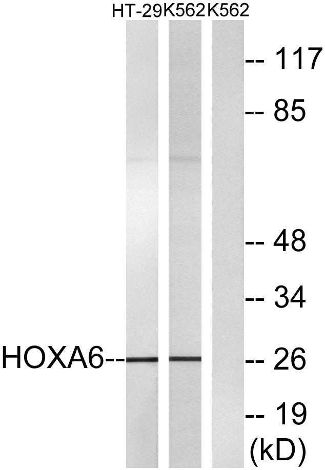 HoxA6 Rabbit Polyclonal Antibody