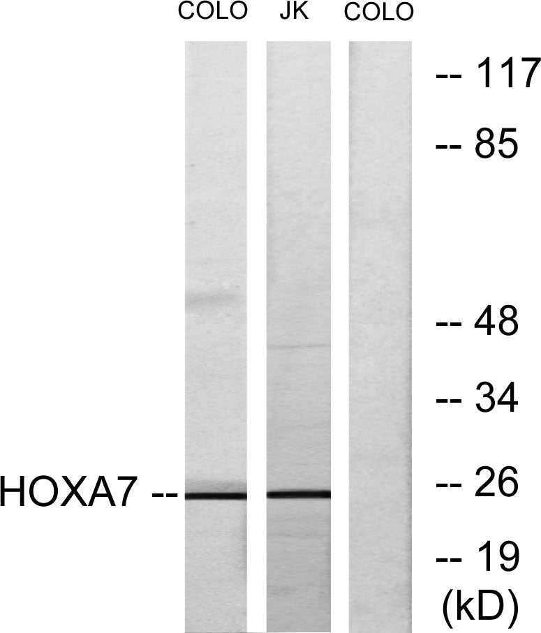 Hox-A7 Rabbit Polyclonal Antibody