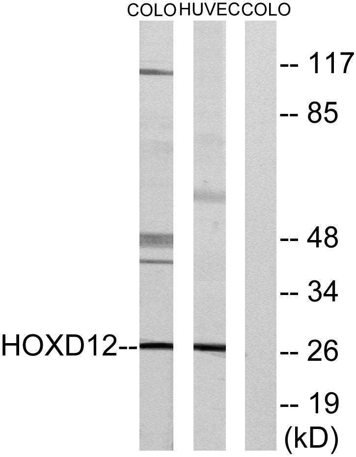 HoxD12 Rabbit Polyclonal Antibody