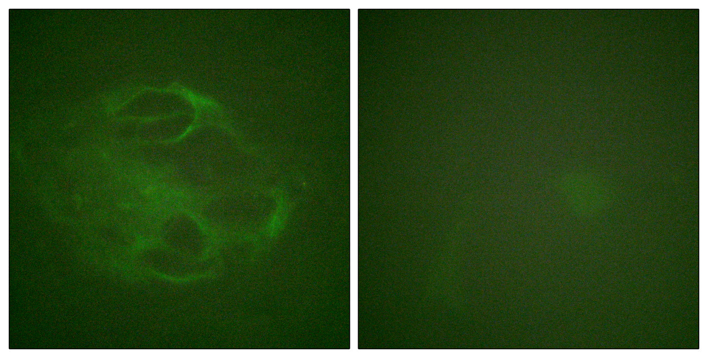 Hrs Rabbit Polyclonal Antibody