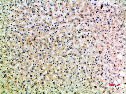 HSP 75 Rabbit Polyclonal Antibody
