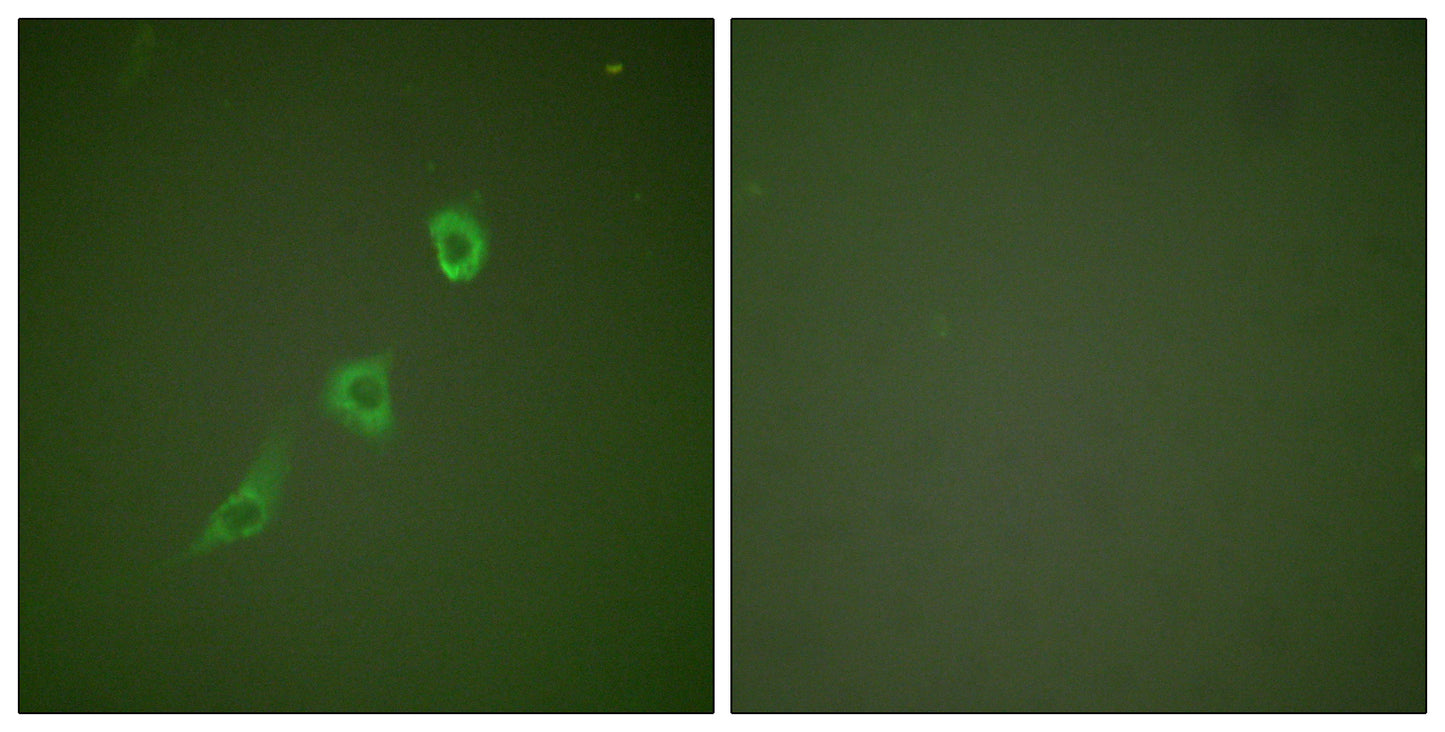 HSP10 Rabbit Polyclonal Antibody
