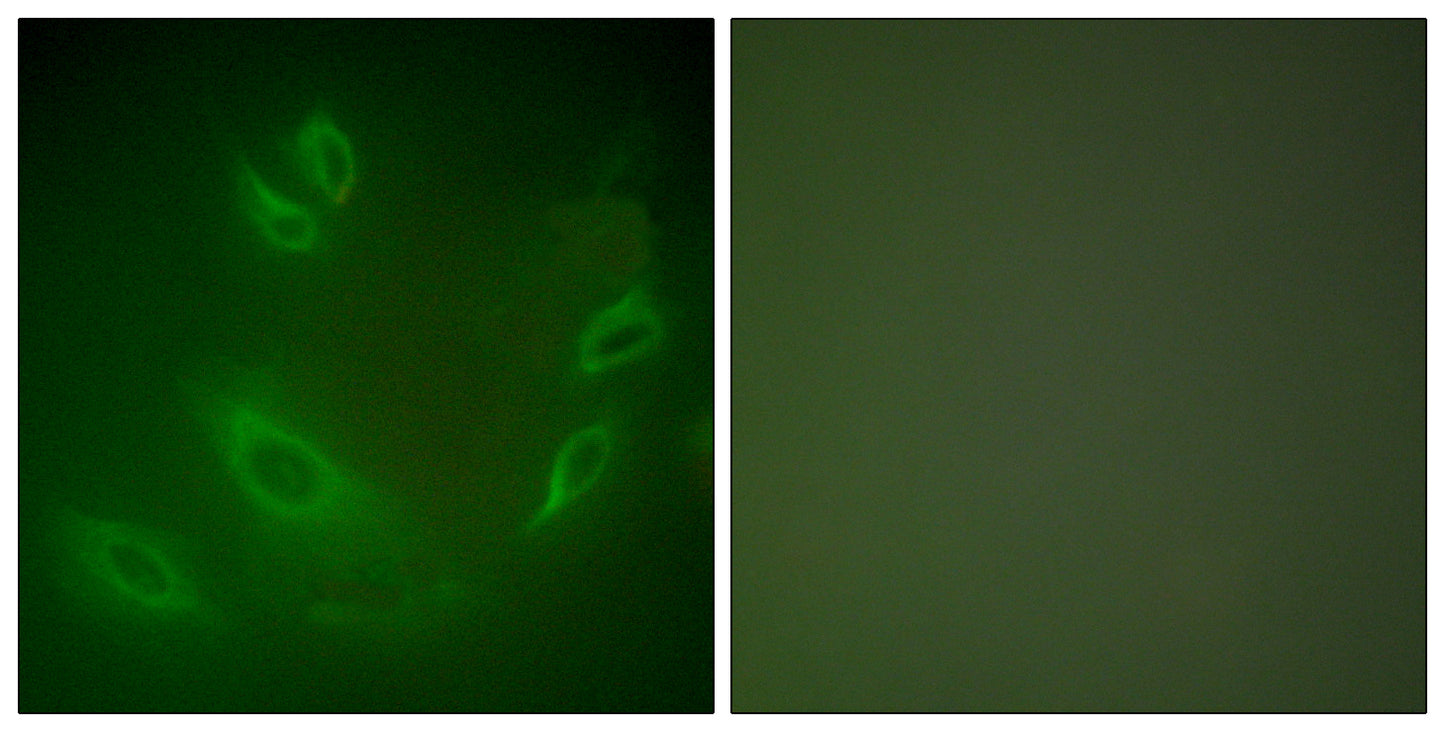 HSP105 Rabbit Polyclonal Antibody