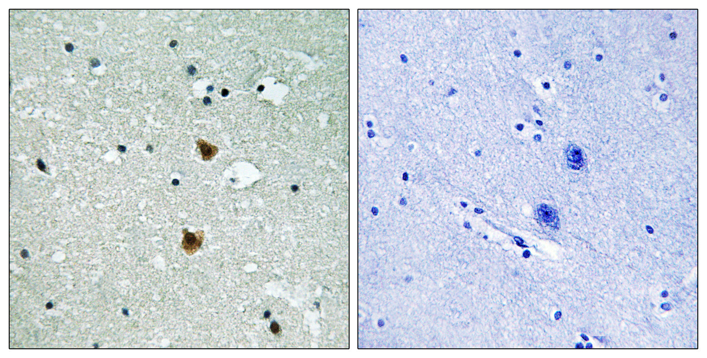 HSP27 Rabbit Polyclonal Antibody
