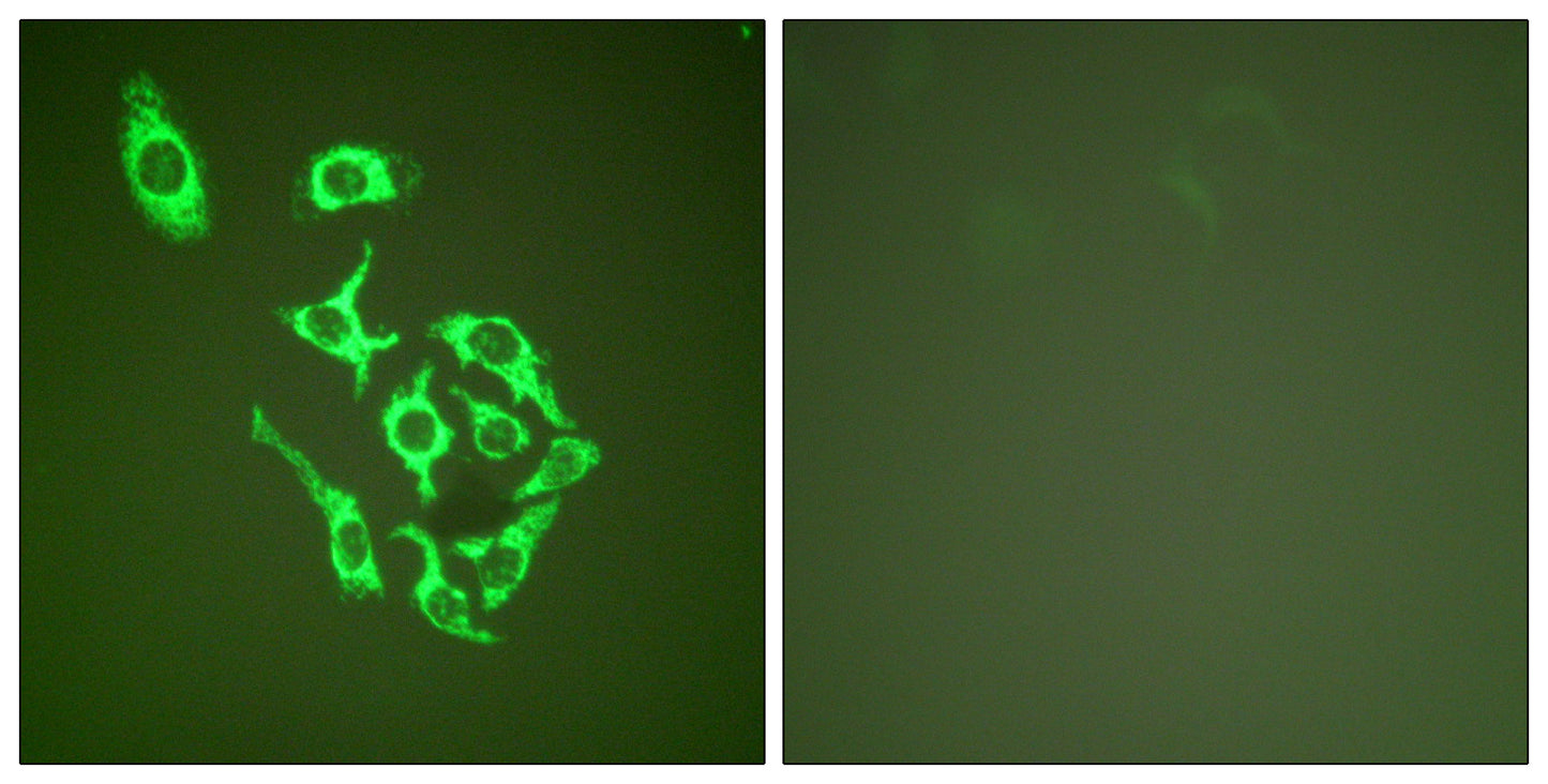 HSP60 Rabbit Polyclonal Antibody