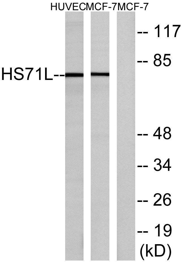 HSP70 Rabbit Polyclonal Antibody