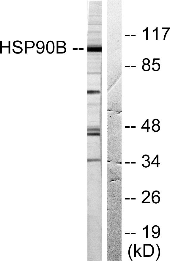 HSP90β Rabbit Polyclonal Antibody