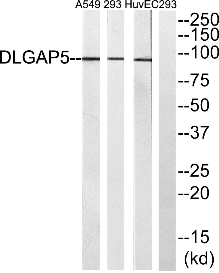 HURP Rabbit Polyclonal Antibody