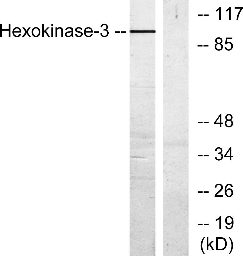 HXK III Rabbit Polyclonal Antibody