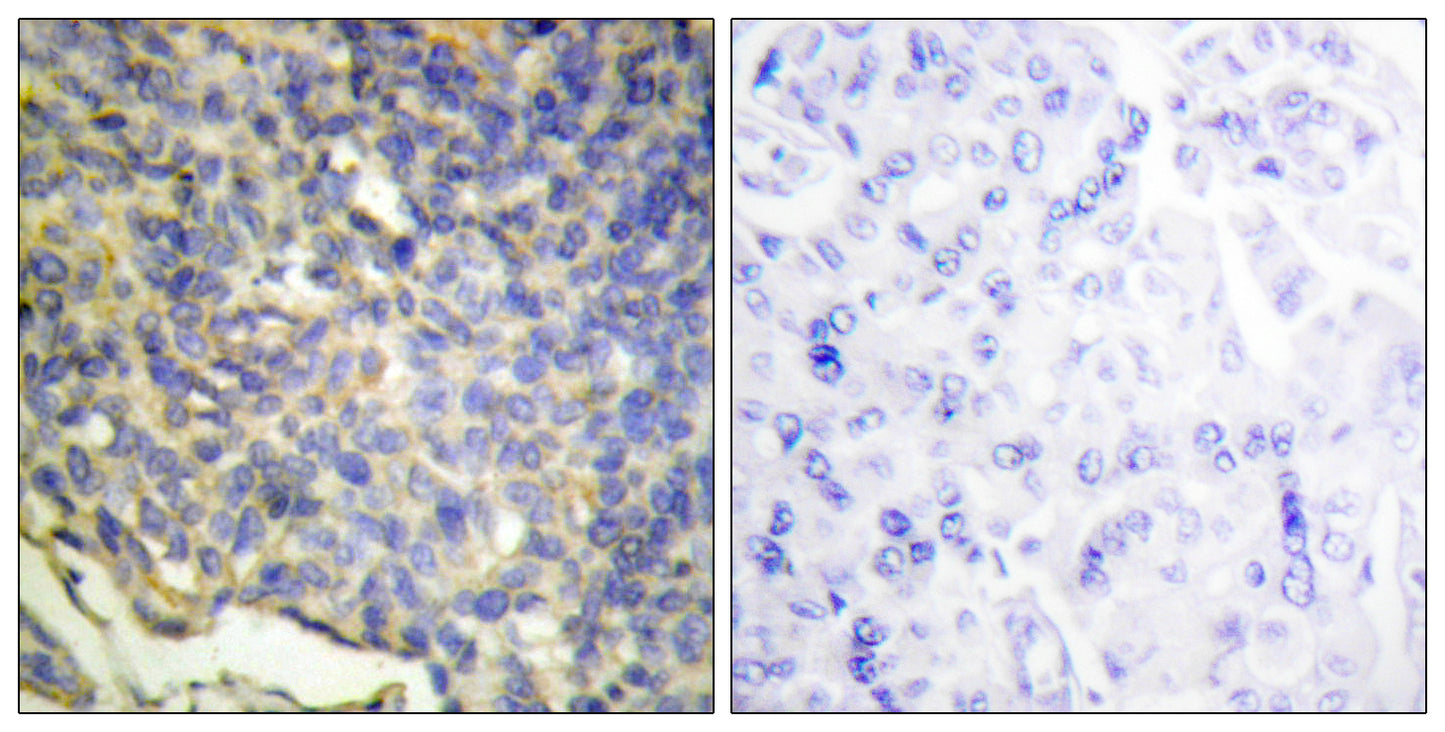 ICAD Rabbit Polyclonal Antibody