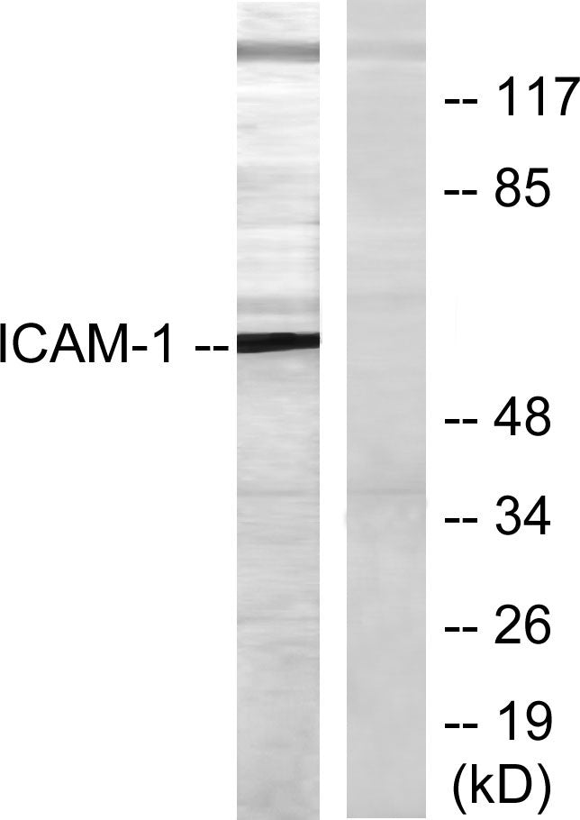 ICAM-1 Rabbit Polyclonal Antibody