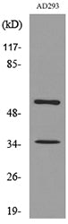IFN-αR2 Rabbit Polyclonal Antibody