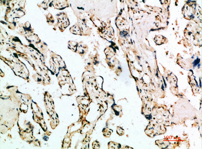 IFN-β Rabbit Polyclonal Antibody