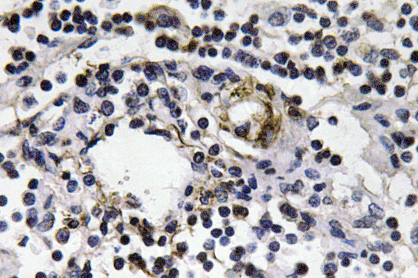 IFN-γ Rabbit Polyclonal Antibody