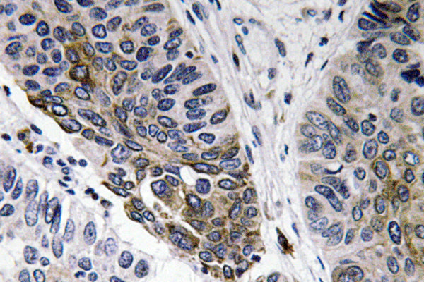 IgA Rabbit Polyclonal Antibody